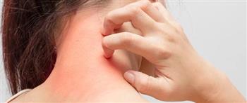 الأعراض التحذيرية المبكرة للسرطان