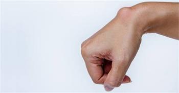 ماذا تعرف عن الكيس الزلالى؟