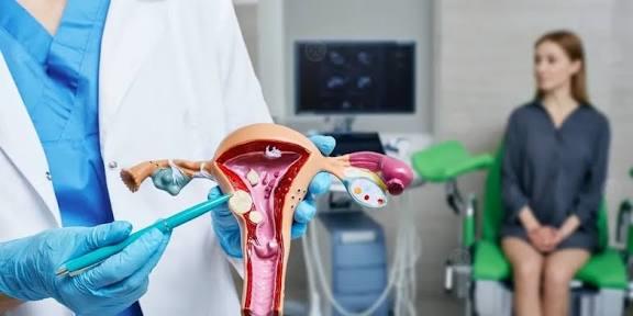 أسباب وأعراض الأورام الليفية الرحمية
