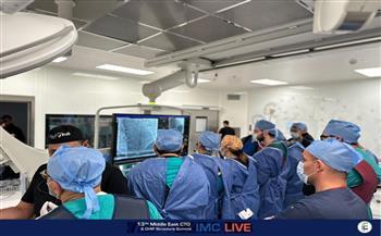فريق طبي بمستشفى العاصمة الجديدة يشارك ببث حي لقسطرة قلبية عالية التعقيد 