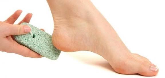 احذر نقص الفيتامينات يسبب تشقق الكعبين