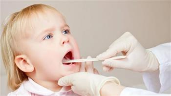 دواعي استئصال اللوزتين للأطفال