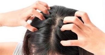 أسباب ألم فروة الرأس