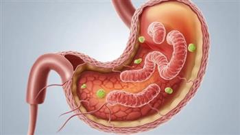 تعرف على أهم أضرار جرثومة المعدة