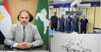 إجراء أول حالة قسطرة مخية لمسنة تعانى من نزيف بالام العنكبوتية بالمخ بمستشفى الزقازيق العام