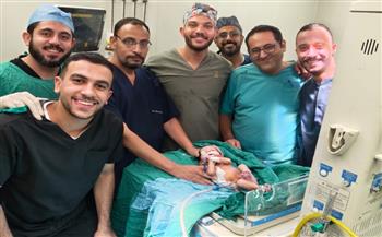 مستشفى أطفال مصر ينجح في إصلاح عيب خِلقي نادر لطفلة حديثة الولادة تبلغ 18 يومًا