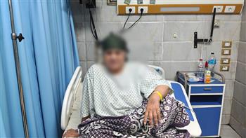 لدغتها الطريشة فى منزلها.. 50 جرعة مصل تنقذ حياة سيدة بمستشفى الزقازيق العام 