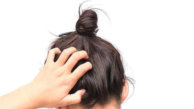 الأسباب الشائعة لحكة فروة الرأس عند الأطفال