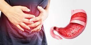 أعراض قرحة المعدة