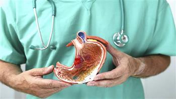 تعرف على الفرق بين سرطان المعدة و سرطان القولون