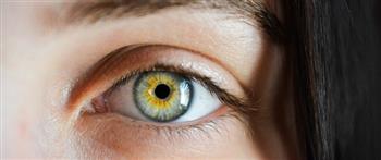 علامات الذبابة الطائرة في العين