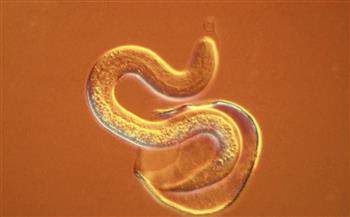 يبتلع أنسجة الضحية.. طفيليّ آكل للحوم يهدّد الولايات المتحدة