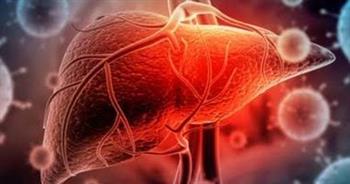 أعراض قد تشير  للإصابة بسرطان الكبد