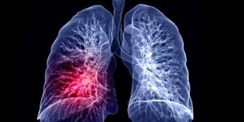 تحرك فورا ... تعرف على علامات الجلطة الرئوية!