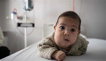 معجزة طبية.. علاج جنين مصاب بورم وعائي نادر في رحم والدته