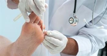 تعرف على أعراض قدم الرياضي 