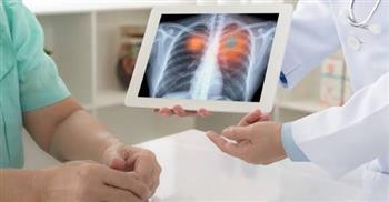 لأصحاب الأمراض الصدرية في شهر رمضان.. اتبع الآتى