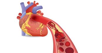 تعرف علي تأثير الصيام على مرضى القلب والشرايين
