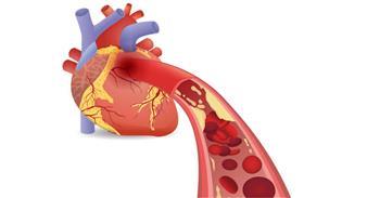 تعرف علي تأثير الصيام على مرضى القلب والشرايين