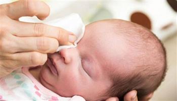 صديد العين عند الأطفال.. متى يكون خطراً؟