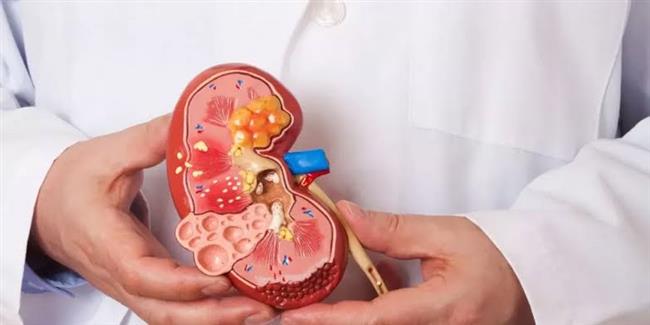 كيف يؤثر الصيام علي مرضي الكلي ؟