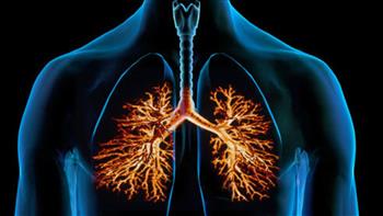 ماذا تعرف عن التهاب الشعب الهوائية المزمن؟