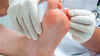 نصائح للقضاء على فطريات القدم في الشتاء