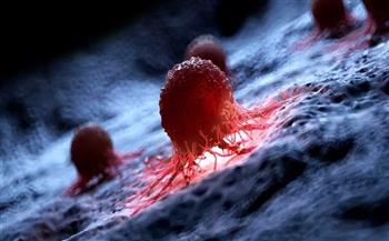 دراسة: اثنين من كل خمسة أنواع من السرطان في جميع أنحاء العالم يمكن الوقاية منها 