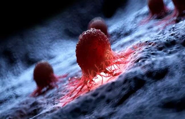 دراسة: اثنين من كل خمسة أنواع من السرطان في جميع أنحاء العالم يمكن الوقاية منها 