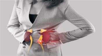 4  مراحل لنزول حصى الكلى