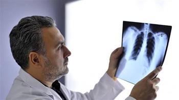 أسباب تليف الرئة