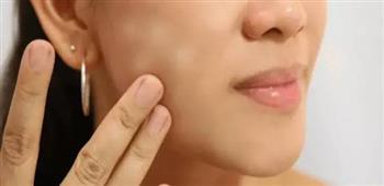 أسباب ظهور بقع بيضاء صغيرة على الجلد