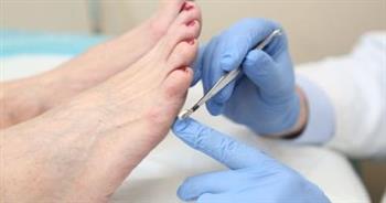 ما هو اعتلال الأعصاب الطرفية؟