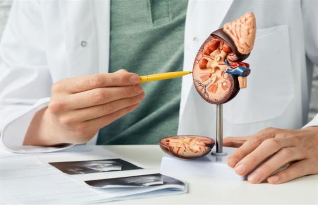 تعرف على أعراض زيادة أملاح الكالسيوم فى البول