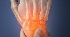 تعرّف على التهاب المفاصل التفاعلي