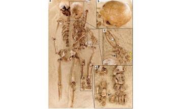 علماء يسجّلون أقدم اضطراب وراثي نادر عمره 12 ألف عام