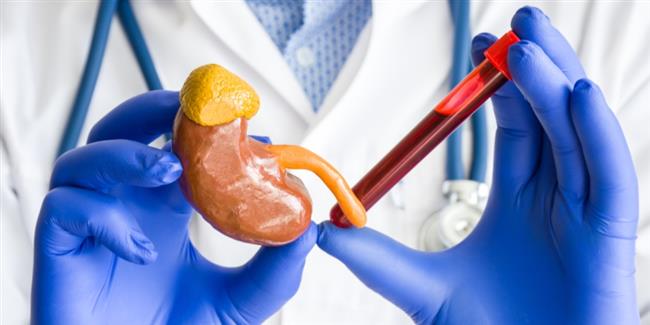 انتبه..أسباب ارتفاع انزيمات الكبد