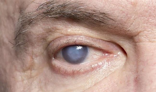 4 خطوات لحماية العين من مضاعفات السكري