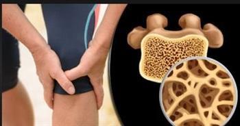 انتبه لمضاعفات هشاشة العظام