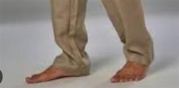 انتبه.. لأعراض الدوالي 