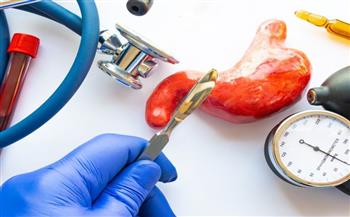 تعرف علي مميزات وعيوب عملية "تحويل المسار"