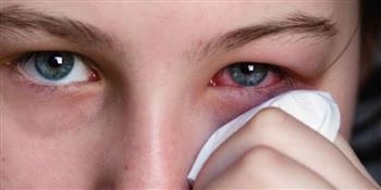 في الربيع ..انتبه لأعراض الرمد الربيعي