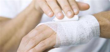 نصائح منزلية للتعامل مع الحروق  البسيطة