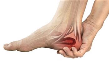 أعراض تشير لالتهاب وتر العرقوب