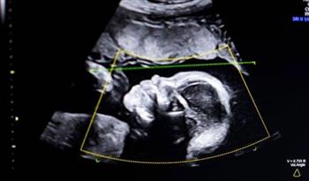 أمريكا تجيز استخدام تقنية تتنبأ بموعد الولادة بالذكاء الاصطناعي