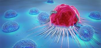 حقيقة تحول الورم الحميد لخبيث!