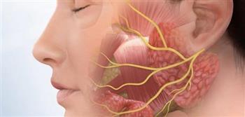 تلك أسباب الإصابة بالعصب الخامس