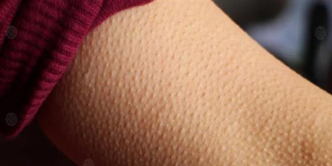 أسباب جلد الوزة وطرق التعامل معها