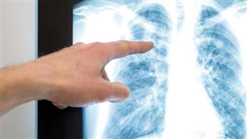 تعرف على الانسداد الرئوي وأعراضه