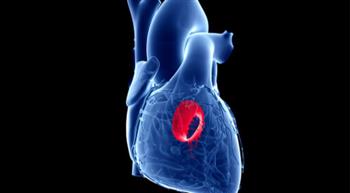 أعراض ارتجاع صمام القلب